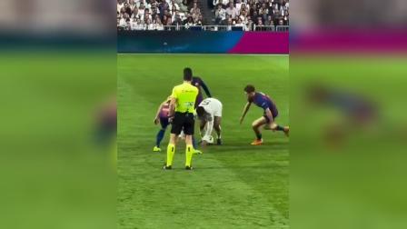 符合重度气道异物梗阻的表现